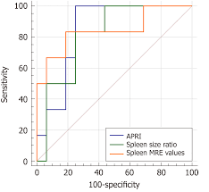 Predicting Gastroesophageal Varices Through Spleen Magnetic