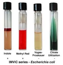 Imvic Series E Coli Microbiology Lab Microbiology Medical Technology Labs