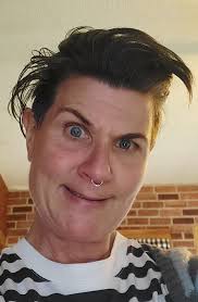 Aaron getting his cast