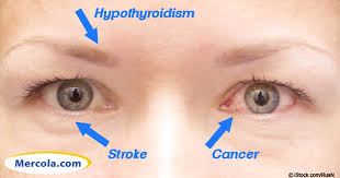 Iridology 14 Things Your Eyes Say About Your Health