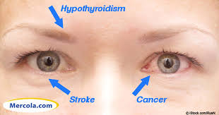 iridology 14 things your eyes say about your health