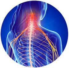 Nervios Pinchados Dolor Irradiante Quiropractico De Charlotte Nc