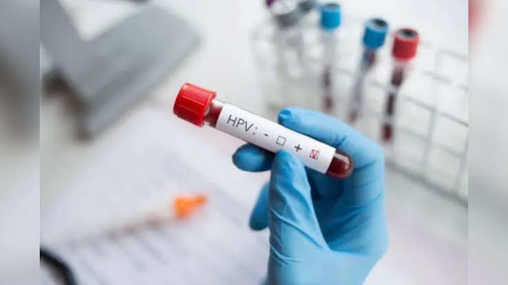 indigenous HPV test validation