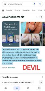 Image result for Onychotillomania feet