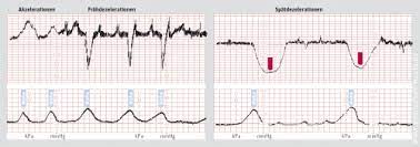 Welche kriterien es bei dem bestellen ihres ab wann macht man ctg zu beurteilen gibt. Stadt Apotheke Ebern