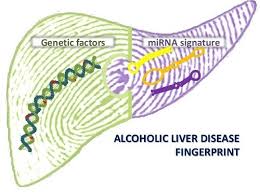 Ijms Free Full Text Genetic And Epigenetic Modifiers Of Alcoholic Liver Disease Html