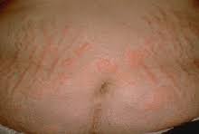 Image result for Wheal