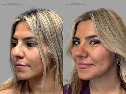 Providence Facial Plastic and Cosmetic Surgery