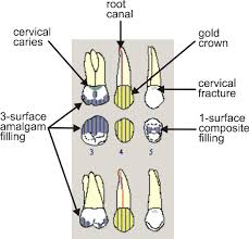 Medical Charting Symbols Qualitative Investigation Of The Content Of Dental Paper Based And Dental Assistant Study Dental Hygiene Student Dental Charting