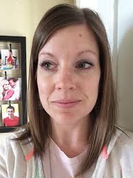 On a Personal Note: What Happened to My Face