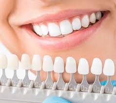 Metal or clear ceramic brackets and aesthetic wires and lingual. Cosmetic Dentist Southfield Mi City Centre Dental Cosmetic Dentistry Improves Smiles