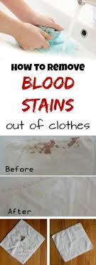 Soak the sheet in cold water. Remove Old Blood Stains