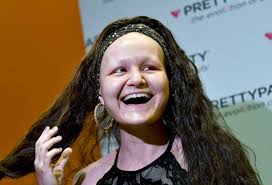 Young cancer patients take a break from the battle at 'Oncology Ball'