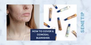How to cover acne, scarring, and discoloration **Base Face **