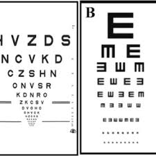 Comparison Of E Chart And Etdrs Chart Nidek Chart Projector