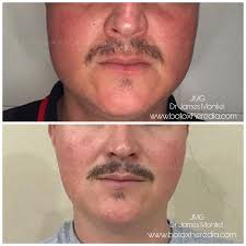 Cirujano Oral, Estética y Armonización