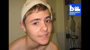 Extraordinary People: Living With Half A Brain