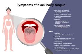 Image result for black hairy tongue symptoms