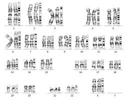 See pictures below of a set of male/female chromosomes, also called a karyotype. Things You Should Know About Male And Female Karyotype Karyotypinghub
