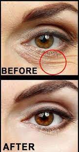 how to remove eye wrinkles now healthy homeremedy healthbenefits exercise howto crowsfeetwrinkles how remove eye wrinkles under eye wrinkles eye wrinkle