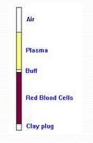 Microhaematocrit Tube Sodium Heparinised 40Μl (Pack Of 100)
