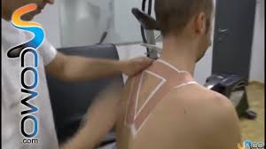 Contractura Muscular Espalda Rectificacion Del Trapecio Youtube