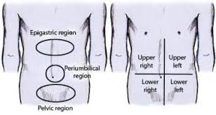 Image result for Shifting Dullness Test