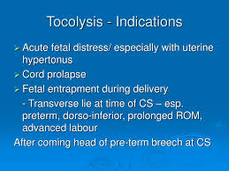 Image result for Tocolytic
