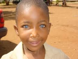 Blacks With Blue Eyes Natural Phenomenon Or Genetic Mutation