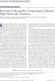 Eosinophilic Myocarditis Complicated by Massive Right Ventricular Thrombus 