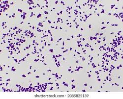 Image result for Staphylococcus Saprophyticus