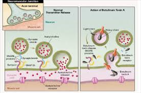 It prevents the release of the neurotransmitter acetylcholine from axon endings at the. Botulinum Toxin Protein Molecule