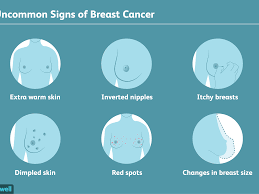 Although this sign is often disregarded, it can be a very subtle warning signal of a very dangerous type of breast cancer. Rare Signs Of Breast Cancer