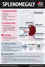 Image result for Splenomegaly