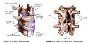 What is ligamentum flavum hypertrophy? Lumbar Spinal Stenosis A Review Of The Treatment Options And Modalities