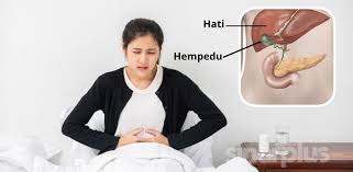 Batu empedu hampir selalu dibentuk dalam kandung empedu dan jarang pada saluran empedu lainnya. Wanita Berisiko Dua Kali Ganda Alami Batu Karang Hempedu Ikuti Penjelasan Pakar Puncanya