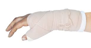 Therapie Eines Speichenbruchs