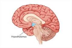 Image result for how do hypothalamus diagnosis change to hypothalamic without treatment