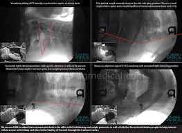 The welsh consumer show fighting for your rights. Digital Motion X Ray Dmx Caring Medical Florida