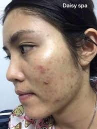 Viện Thẩm Mỹ Daisy