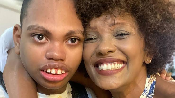 Isabel Fillardis comemora aniversário de 21 anos do filho que nasceu com  síndrome rara - Pais e Filhos