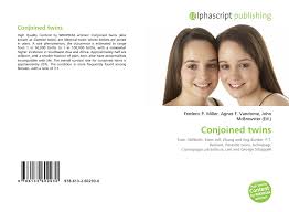 Â the twin girls were born in 1961, and it was believed that they not only shared blood vessels in the brain, but also had a fused brain. Conjoined Twins 978 613 2 60293 0 6132602933 9786132602930