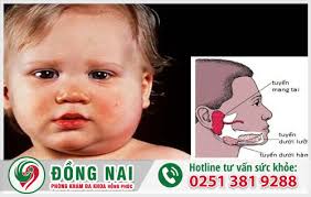 Viêm mào tinh hoàn ở trẻ em