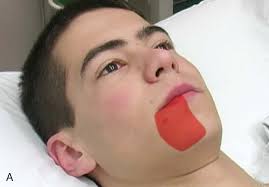 Dental Emergencies: Management Strategies That Improve Outcomes