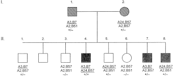 pedigree of the family with hs and hemochromatosis healthy