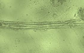 Image result for Morinda lucida