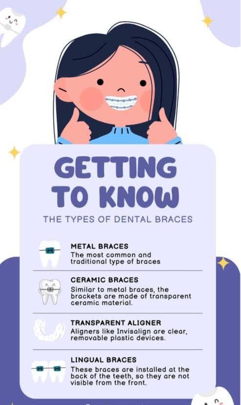 Braces product image