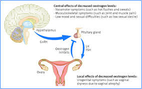 Diagnosis And Management Of Menopause Summary Of Nice Guidance The Bmj