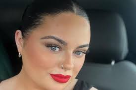 Chciała pozbyć się podwójnego podbródka. Zrobiła liposukcję i twierdzi, że  wygląda jak postać ze Shreka