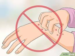 3 Formas De Aliviar La Comezon De Las Manos Y Los Pies En La Noche